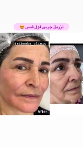 کلینیک سیب سبز لیزر و زیبایی